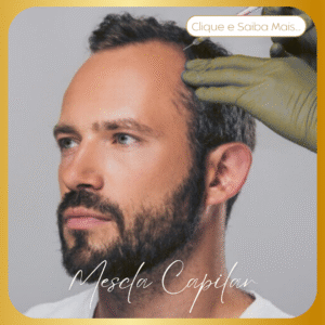 Mescla Capilar​