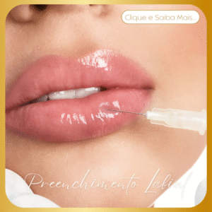 Preenchimento Labial​