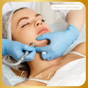 Peeling de Diamante
