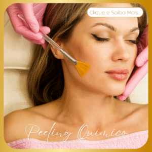 Peeling Químico​
